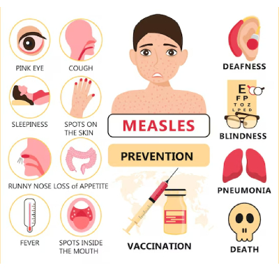 Measles Awareness